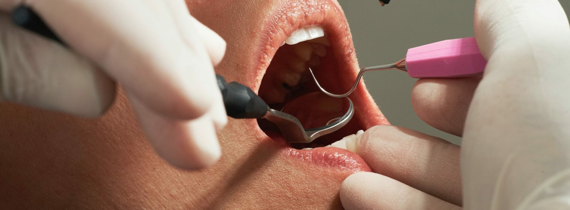 Dobry stomatolog Łódź – na co zwrócić uwagę wybierając lekarza?